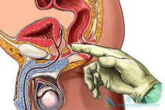 ���Ʀ�-catenin�ź�ͨ·����ת����³��(XTANDI)��ҩ