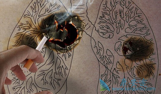 吉非替尼 吉非替尼