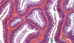 ��������/������ҩ�������ΰ���ת�ƻ�����Ч���Ƕ���