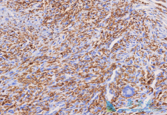 ��������(Nilotinib)����Ч���������Ծ�ϸ�������ߵļ�����չ