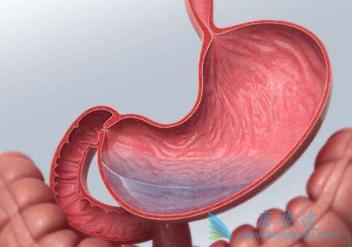 奥拉帕尼 奥拉帕尼