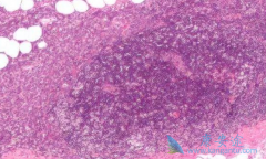 ��Ī����/������ŵ�ߵ�ʿͣҩ�೤ʱ����Ի���