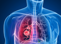 ͨ���Կ�����/������������ĵ����ܻ����䲻����Ӧ��