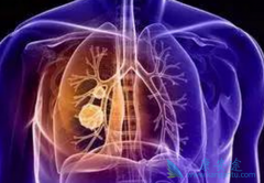 ���е�EGFRͻ��ΰ�����һ�߶����Է��ð�ϣ����(OSIMERTINIB)��