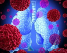 ��������(ERLOTINIB)���й��ΰ����ߵļ��������ʸߴ�81%