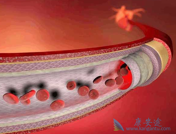 心脏支架 心脏支架