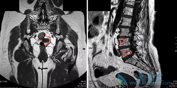 癌症传统治疗 癌症传统治疗