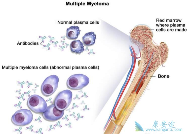 癌症的治疗 癌症的治疗