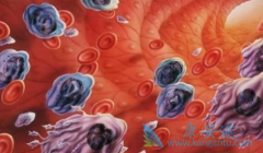 ��Ѫ������ҩ����������(Nilotinib)����������������ɭ֢