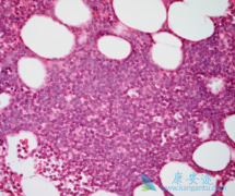 ��³����/�������������������������ܰ�ϸ����Ѫ��