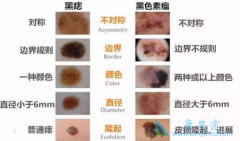 �����ĺ�ɫ���������Ʒ�������Щ��