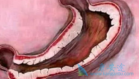 曲妥珠单抗 曲妥珠单抗