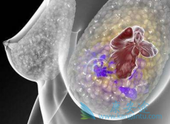 ����ҩ����������(Ibrance)���������������ٰ�����