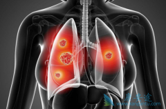 ��������(ERLOTINIB)�����ڼ������Щ�������Ӧ���Ժ���