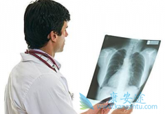 ����ҩ����������(Sunitinib)�ܸ���Сϸ���ΰ����ߵ���������