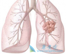 ����ҩ����̹(Suninat)�Բ��ַ�Сϸ���ΰ����ߵĻ����ʸߴ�66.7%