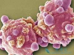 ʩ����(Sprycel)�ܴ���Ѫ����������BCR-ABL���Լ��԰�Ѫ��