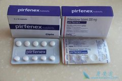 ������ͪ(pirfenidone)���Ʒ���ά���İ�ȫ�Ժ�����������