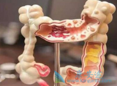 �������͵Ľ�ֱ���������ܴ����ᵥ��(Vectibix)��ҩ�����л���