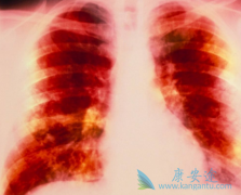 ���ڷΰ����߷������޿�/���������������ʲô�仯