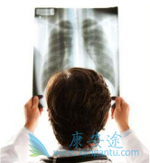 �����ΰ�ҩ�ﰢ������(Gilotrif)��Ѫ�����ϴ�͸�Ժ���