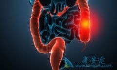 KRASҰ���ͽ�ֱ��������һ������Ӧ��ѡ����������/�����ض�