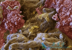 ��������(Cabozantinib)�����ڼ仼���ܳ���ҩ��