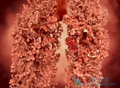 ���߷��ÿ�������(XL184)����ֳ�Ѫ֢״��ôӦ��