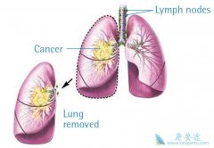 ���Сϸ���ΰ��ķ�����������Щ