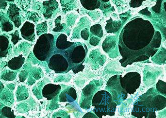 吡非尼酮 吡非尼酮