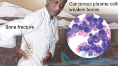 ������ҩ����ȫ��CD38��������ҩ�о�