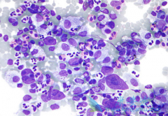 ����������(Adcetris)�뿹��ҩ����ù�����û����ӷ��඾��