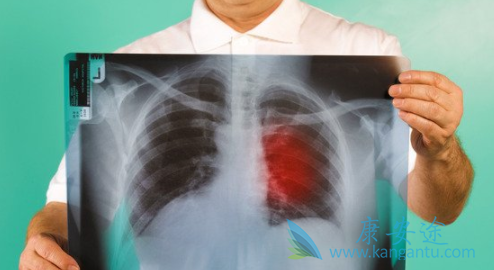 布加替尼 布加替尼