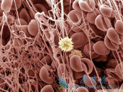 鲁索替尼 鲁索替尼