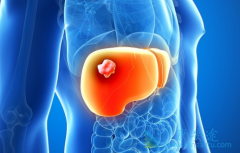 ��Ī¬����(ramucirumab)��AFP���ߵĸΰ����ߵ�����Ч����