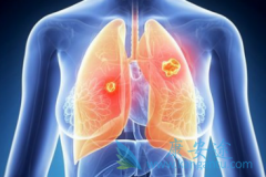 ��������(xalkori)�������ڷΰ��������ܳ�������