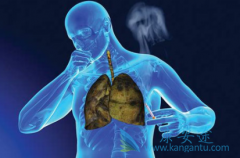 Ϊʲô��������(Cabozantinib)�ڶ���ʵ�����ж��в�������Ч