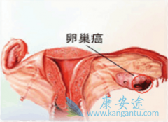 �ѳ������߷��ð�������/����׿ǰ��Ҫ����������