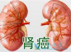 ��������/���������ܸ����������ߵ�Ԥ����