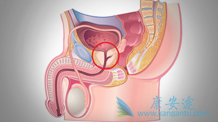 阿比特龙 阿比特龙