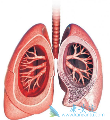 吡非尼酮 吡非尼酮