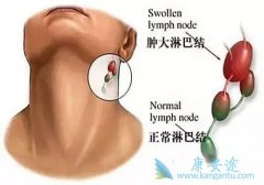 �ܰͰ�֢״ͨ������Щ����Щ֢״�������ܰͰ������ڱ��֣�