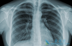 ��Сϸ���ΰ���KARSͻ����RAS��������һԱ