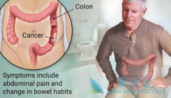 RASͻ��ĳ���������Ŀǰ��Ҫ��ȡ��Щ������