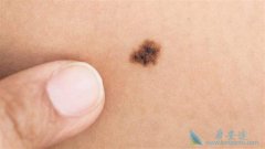 ��ɫ������ɫ�����������ʲô������μ���