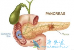 Ϊʲô���఩���Է��֣����఩֢״����Щ��