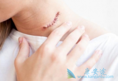 ��״����������֢״��������Щ��������Ҫ������