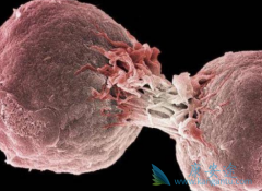 t���ܰ�������ʲô����ģ�t���ܰ������Ʒ�������Щ��