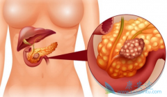 ���ٰ�������ҩ����˼�����������ʲô