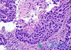 ��ͬ�����͵ķ���״ϸ��������ҩ��Ҳ��һ��